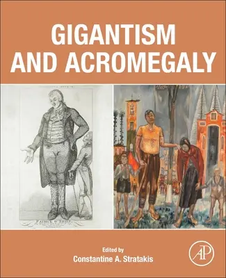 Gigantismo y acromegalia - Gigantism and Acromegaly