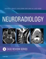 La búsqueda de los hititas: el descubrimiento de una civilización olvidada - Neuroradiology Imaging Case Review