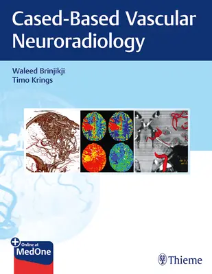 Imágenes en la enfermedad neurovascular: Un enfoque basado en casos - Imaging in Neurovascular Disease: A Case-Based Approach