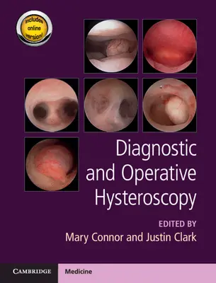 Histeroscopia diagnóstica y operatoria - Diagnostic and Operative Hysteroscopy