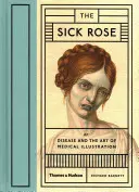 Sick Rose - Or; Disease and the Art of Medical Illustration (La rosa enferma o la enfermedad y el arte de la ilustración médica) - Sick Rose - Or; Disease and the Art of Medical Illustration