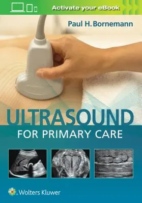 Ecografía para Atención Primaria [Con eBook] - Ultrasound for Primary Care [With eBook]