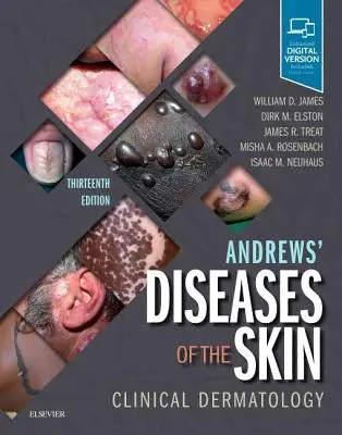 Enfermedades de la piel de Andrews: Dermatología Clínica - Andrews' Diseases of the Skin: Clinical Dermatology