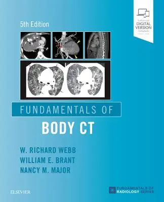 Fundamentos de la TC corporal - Fundamentals of Body CT