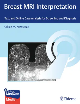 Breast MRI Interpretation: Texto y análisis de casos en línea para la detección y el diagnóstico - Breast MRI Interpretation: Text and Online Case Analysis for Screening and Diagnosis