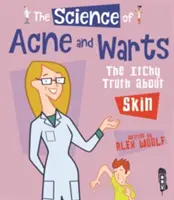 La ciencia del acné y las verrugas - La picante verdad sobre la piel - Science Of Acne & Warts - The Itchy Truth About Skin