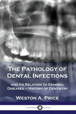 La patología de las infecciones dentales: y su relación con las enfermedades generales - Historia de la Odontología - The Pathology of Dental Infections: and Its Relation to General Diseases - History of Dentistry