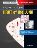 Especialidad en Imagen: Hrct of the Lung - Specialty Imaging: Hrct of the Lung