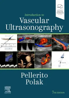 Introducción a la ecografía vascular - Introduction to Vascular Ultrasonography