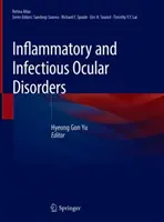 Trastornos oculares inflamatorios e infecciosos - Inflammatory and Infectious Ocular Disorders