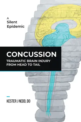 Conmoción cerebral: La lesión cerebral traumática de la cabeza a los pies - Concussion: Traumatic Brain Injury from Head to Tail