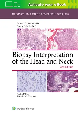 Interpretación de biopsias de cabeza y cuello - Biopsy Interpretation of the Head and Neck