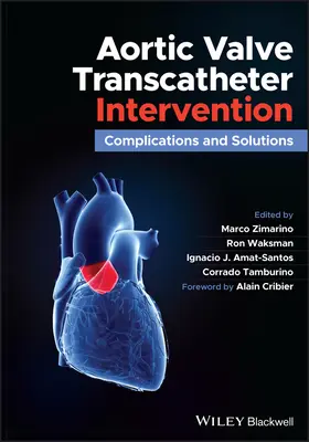 Intervención transcatéter de la válvula aórtica: Complicaciones y soluciones - Aortic Valve Transcatheter Intervention: Complications and Solutions