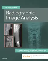 Análisis de imágenes radiográficas - Radiographic Image Analysis