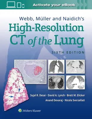 TAC pulmonar de alta resolución de Webb, Mller y Naidich - Webb, Mller and Naidich's High-Resolution CT of the Lung