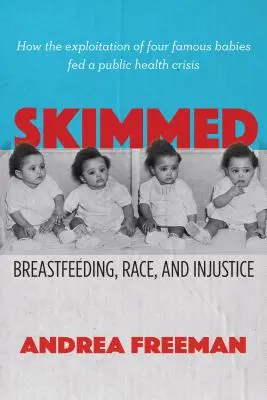 Descremada: Lactancia materna, raza e injusticia - Skimmed: Breastfeeding, Race, and Injustice