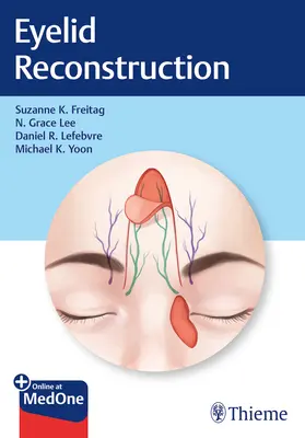 Reconstrucción de párpados - Eyelid Reconstruction