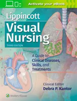 Enfermería Visual Lippincott: Guía de enfermedades clínicas, habilidades y tratamientos - Lippincott Visual Nursing: A Guide to Clinical Diseases, Skills, and Treatments