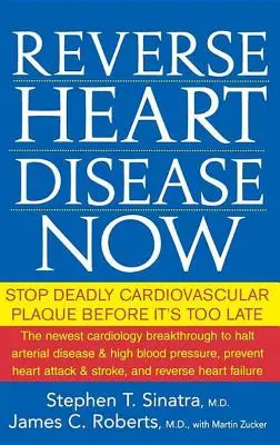 Reverse Heart Disease Now: Detenga la placa cardiovascular mortal antes de que sea demasiado tarde - Reverse Heart Disease Now: Stop Deadly Cardiovascular Plaque Before It's Too Late