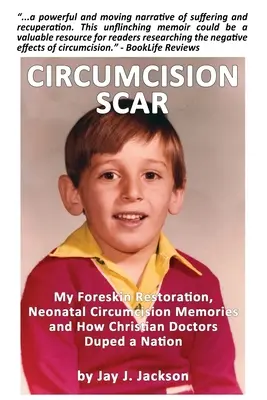 Circumcision Scar: My Foreskin Restoration, Neonatal Circumcision Memories and How Christian Doctors Duped a Nation (Mi restauración del prepucio, recuerdos de la circuncisión neonatal y cómo los médicos cristianos engañaron a una nación) - Circumcision Scar: My Foreskin Restoration, Neonatal Circumcision Memories and How Christian Doctors Duped a Nation