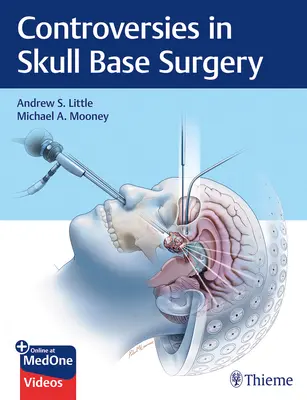 Controversias en la cirugía de la base del cráneo - Controversies in Skull Base Surgery