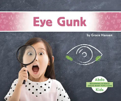 Mugre ocular - Eye Gunk