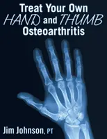 Trate su propia artrosis de mano y pulgar - Treat Your Own Hand and Thumb Osteoarthritis