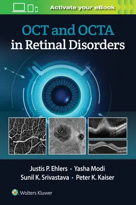 Oct y Octa en los trastornos de la retina - Oct and Octa in Retinal Disorders