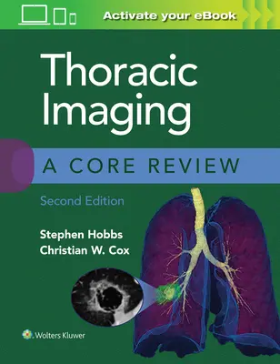 Imagen torácica: A Core Review - Thoracic Imaging: A Core Review