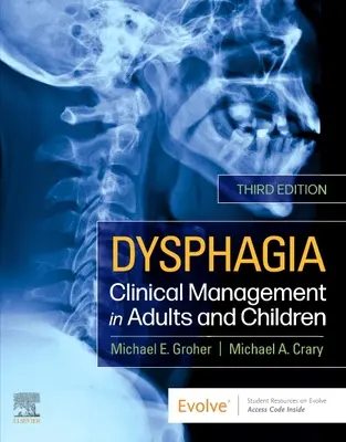 Disfagia - Manejo clínico en adultos y niños - Dysphagia - Clinical Management in Adults and Children