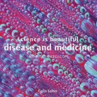 La ciencia es bella: Enfermedad y Medicina: Bajo el microscopio - Science Is Beautiful: Disease and Medicine: Under the Microscope