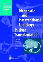 Radiología diagnóstica e intervencionista en el trasplante hepático - Diagnostic and Interventional Radiology in Liver Transplantation