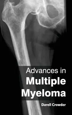 Avances en mieloma múltiple - Advances in Multiple Myeloma