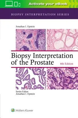 Interpretación de la biopsia de próstata - Biopsy Interpretation of the Prostate