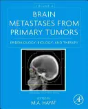 Metástasis cerebrales de tumores primarios, Volumen 2: Epidemiología, biología y terapia - Brain Metastases from Primary Tumors, Volume 2: Epidemiology, Biology, and Therapy