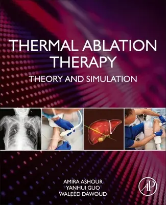 Terapia de ablación térmica: Teoría y simulación - Thermal Ablation Therapy: Theory and Simulation
