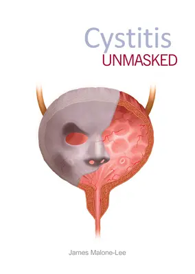 Cistitis desenmascarada - Cystitis Unmasked