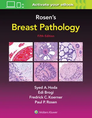 Patología mamaria de Rosen - Rosen's Breast Pathology