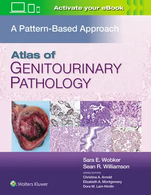 Atlas de Patología Genitourinaria: Un enfoque basado en patrones - Atlas of Genitourinary Pathology: A Pattern Based Approach