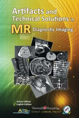 Artifacts and Technical Solutions in MR Diagnostic Imaging (Artefactos y soluciones técnicas en el diagnóstico por imagen de RM) - Artifacts and Technical Solutions in MR Diagnostic Imaging