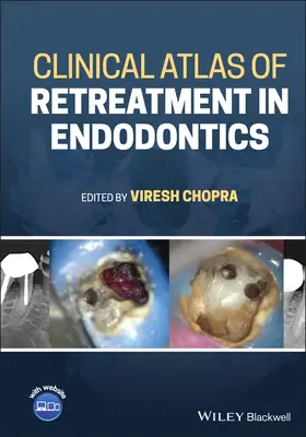 Atlas clínico de retratamiento en endodoncia - Clinical Atlas of Retreatment in Endodontics