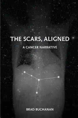 Las cicatrices, alineadas - The Scars, Aligned