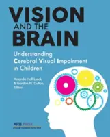 La visión y el cerebro: Comprender la deficiencia visual cerebral en los niños - Vision and the Brain: Understanding Cerebral Visual Impairment in Children