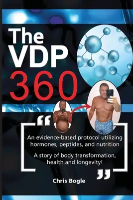 El VDP360 - The VDP360