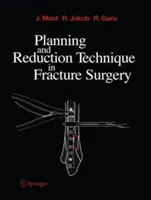 Planificación y técnica de reducción en cirugía de fracturas - Planning and Reduction Technique in Fracture Surgery