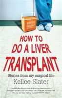 Cómo hacer un trasplante de hígado: Historias de mi vida quirúrgica - How to do a liver transplant: Stories from my surgical life