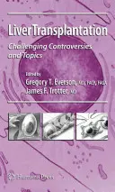 Trasplante de hígado: Controversias y temas desafiantes - Liver Transplantation: Challenging Controversies and Topics