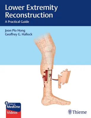 Reconstrucción de las extremidades inferiores: Una guía práctica - Lower Extremity Reconstruction: A Practical Guide