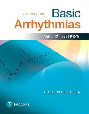Arritmias básicas - Basic Arrhythmias