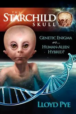 El cráneo de Starchild: ¿enigma genético o híbrido humano-extraterrestre? - The Starchild Skull -- Genetic Enigma or Human-Alien Hybrid?